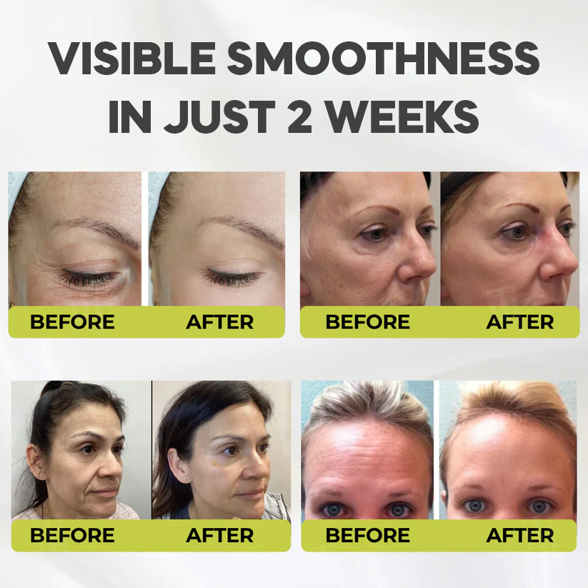 Casari Vita A Retinal Cream™ - Remove wrinkles in 25 days