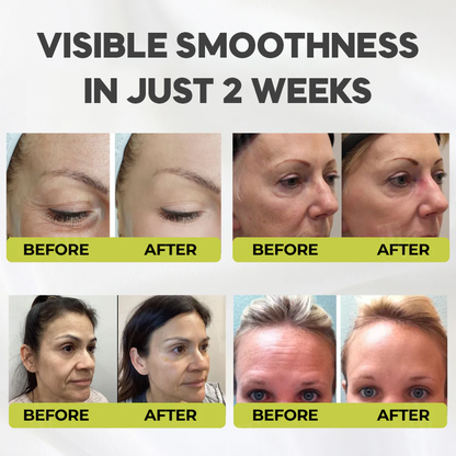 Casari Vita A Retinal Cream™ - Remove wrinkles in 25 days