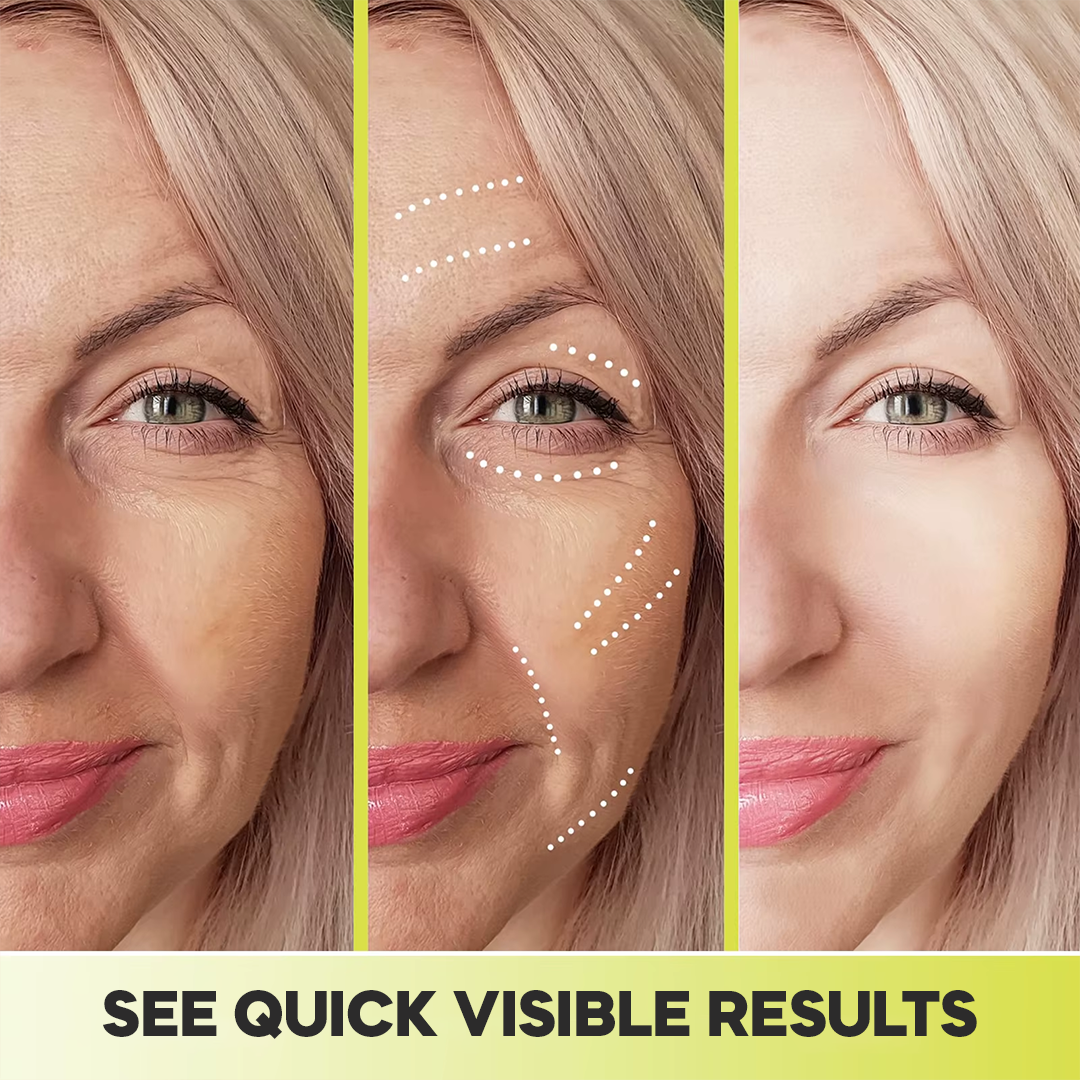 Casari Vita A Retinal Cream™ - Remove wrinkles in 25 days