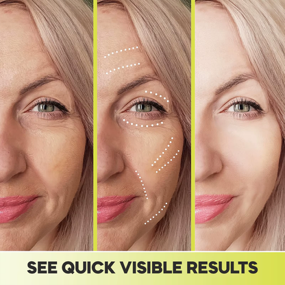 Casari Vita A Retinal Cream™ - Remove wrinkles in 25 days